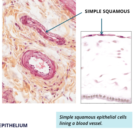 Simple Squamous