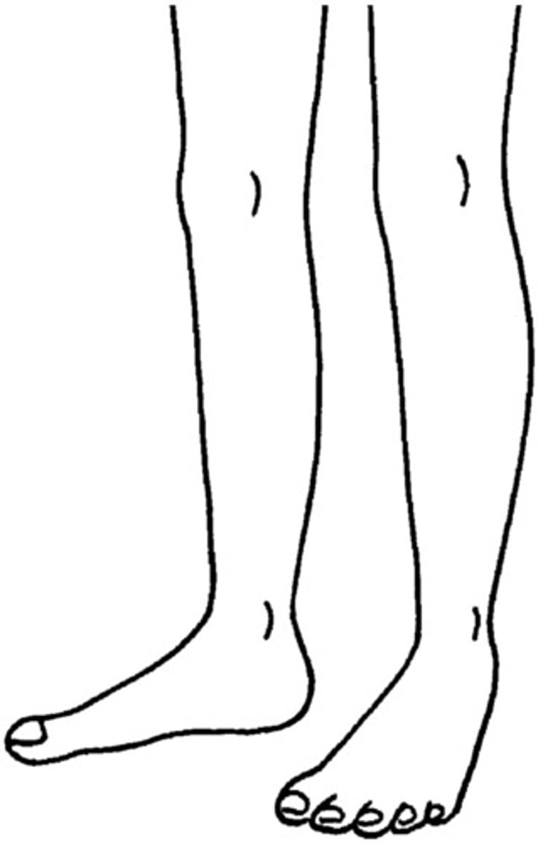 <p>leg; foot</p>
