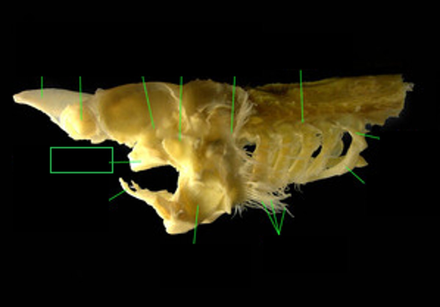 <p>Top part of mandibular arch</p>