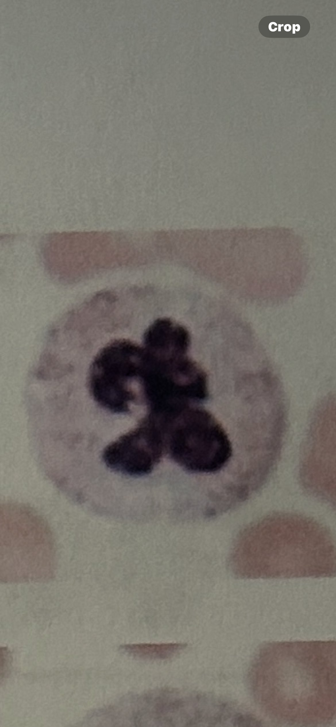<p>WBC</p>