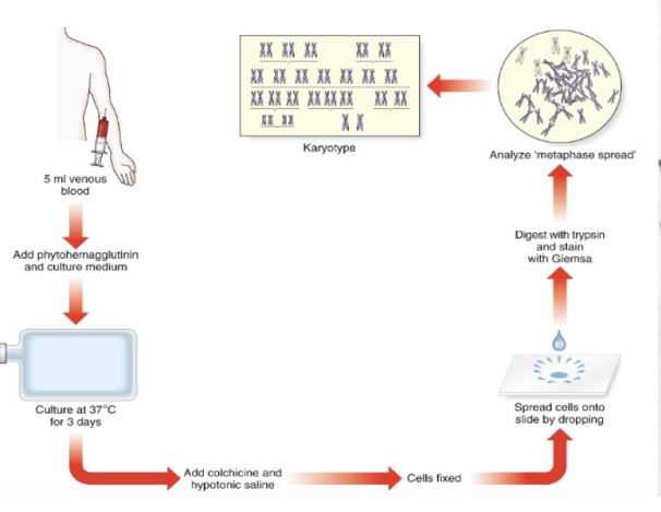 <p>Karyotype is a test to identify and evaluate the size, shape, and number of chromosomes in a sample of cells </p><p></p><ul><li><p> Phytohemagglutinin: Stimulates cell division </p></li><li><p>Colchicine: Arrests cells in metaphase </p></li><li><p>Trypsin: Enhances chromosome banding by breaking down nonhistone proteins</p></li></ul><p></p><p></p><p></p>