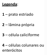 <p>epitélio simples colunar </p>