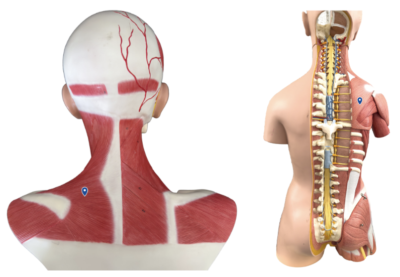 <p>What muscle is the arrow pointing to?</p>