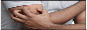 <p>The condition of itching; may be associated with  \n many diseases, especially allergic reactions on  \n the skin.</p>