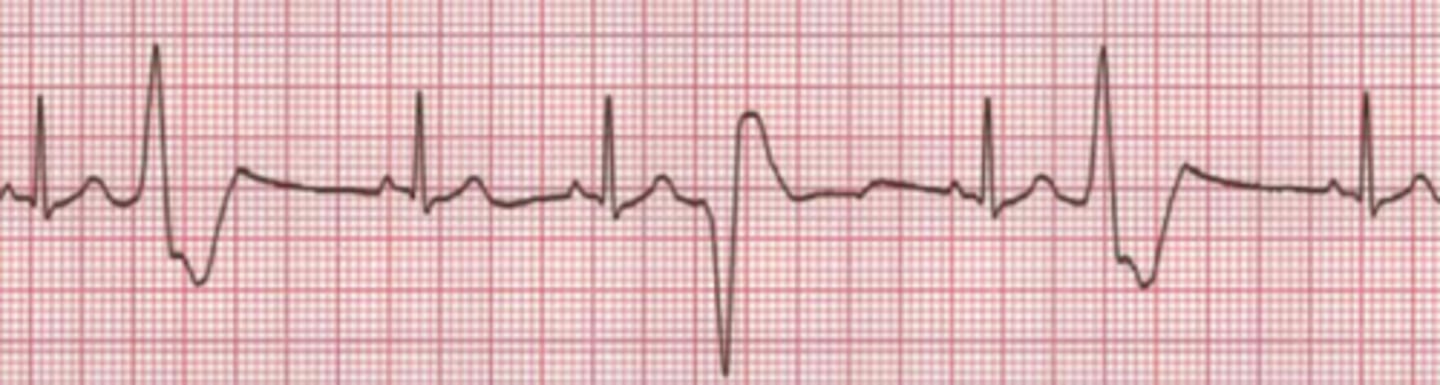 <p>Name the rhythm</p>