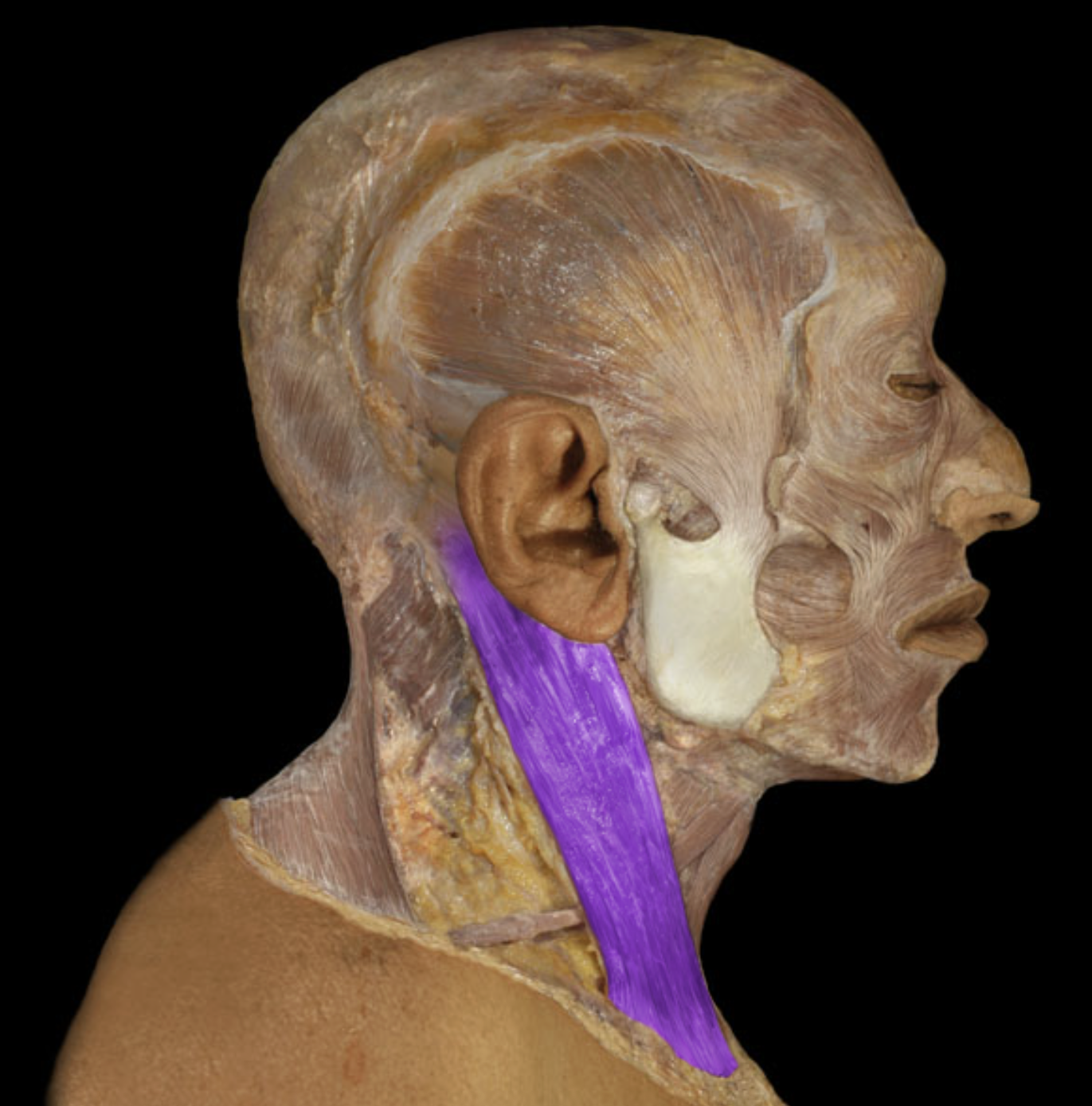 <p>What is/are this muscle’s insertion(s)?</p>