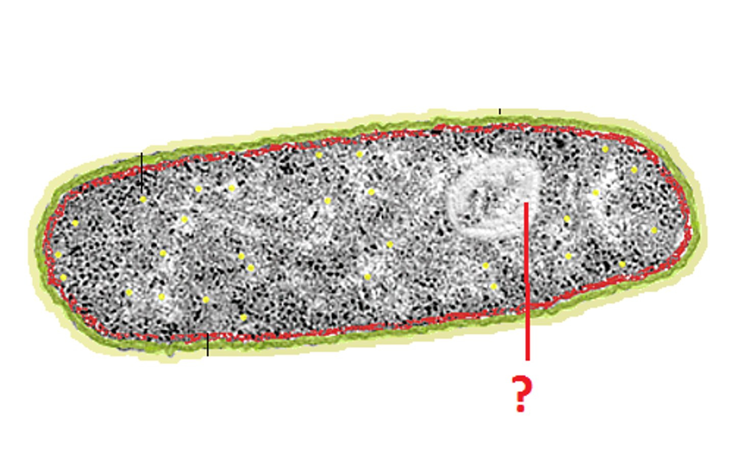 <p>densly staining DNA region in a prokaryotic cell</p>