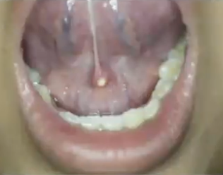 <p>What is the diagnosis?</p>