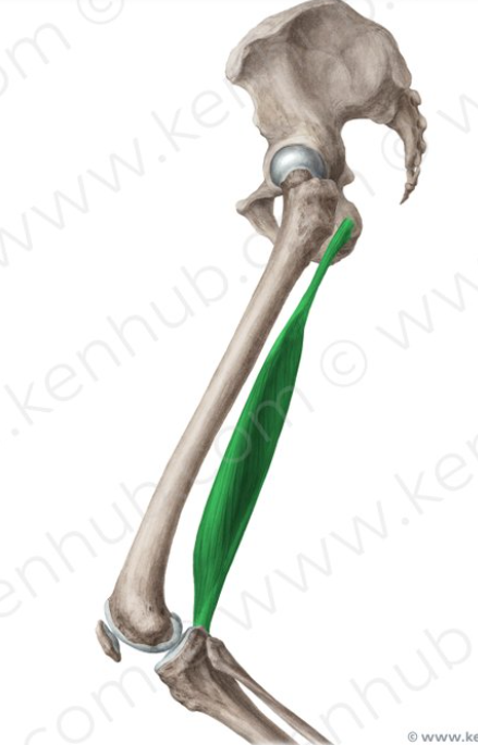 <p>Semimembranosus origins/insertions</p>