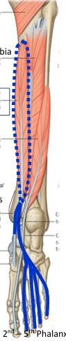 <p>Name this muscle </p>
