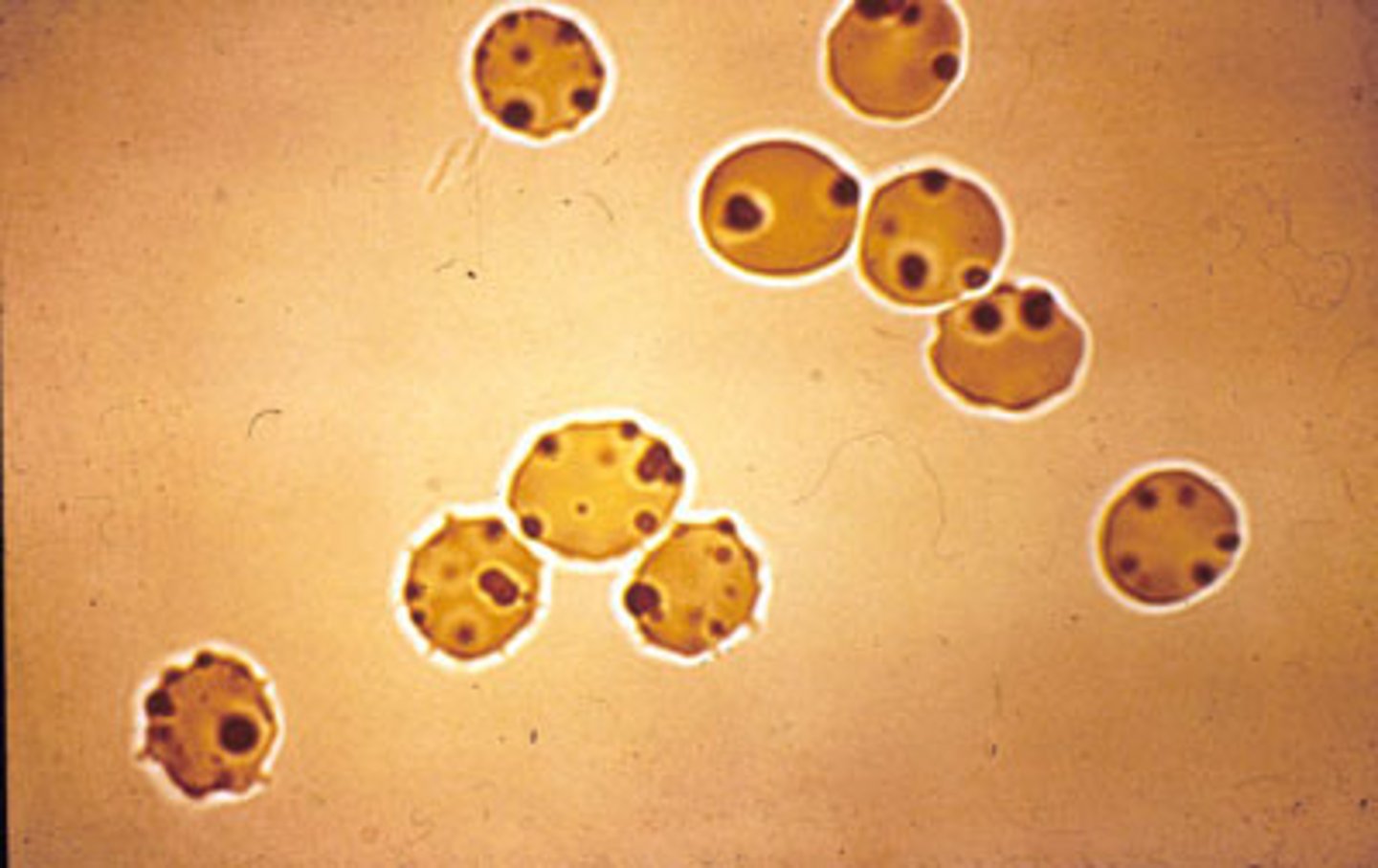 <p>Heinz bodies - precipitated haemoglobin within RBC altering their rigidity </p>