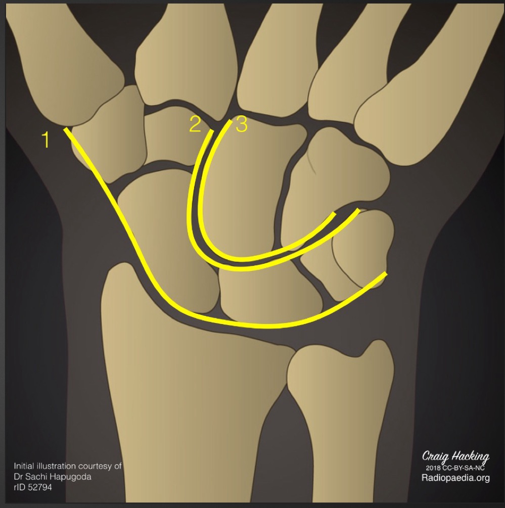 <p>what is this measurement called and what is considered normal </p>