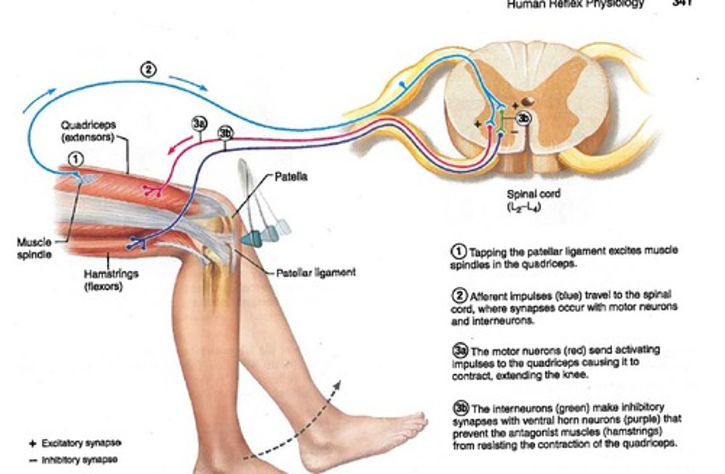 <p>Stimulus: tap to tendon - detects stretch in muscle</p><p>Receptor: muscle spindle stretch receptors</p><p>Desired Action:</p><p>- # synapses: monosynaptic</p><p>- Ipsi-contra?: ipsilateral</p><p>- Effect on alpha motor neuron: excitation, causes it to contract and swing forward</p><p>Reciprocal inhibition: antagonist flexor must relax</p><p>- # synapses: poly (2)</p><p>- Ipsi-contra?:</p><p>ipsilateral</p><p>- effect on alpha motor neuron: relax hamstring</p>