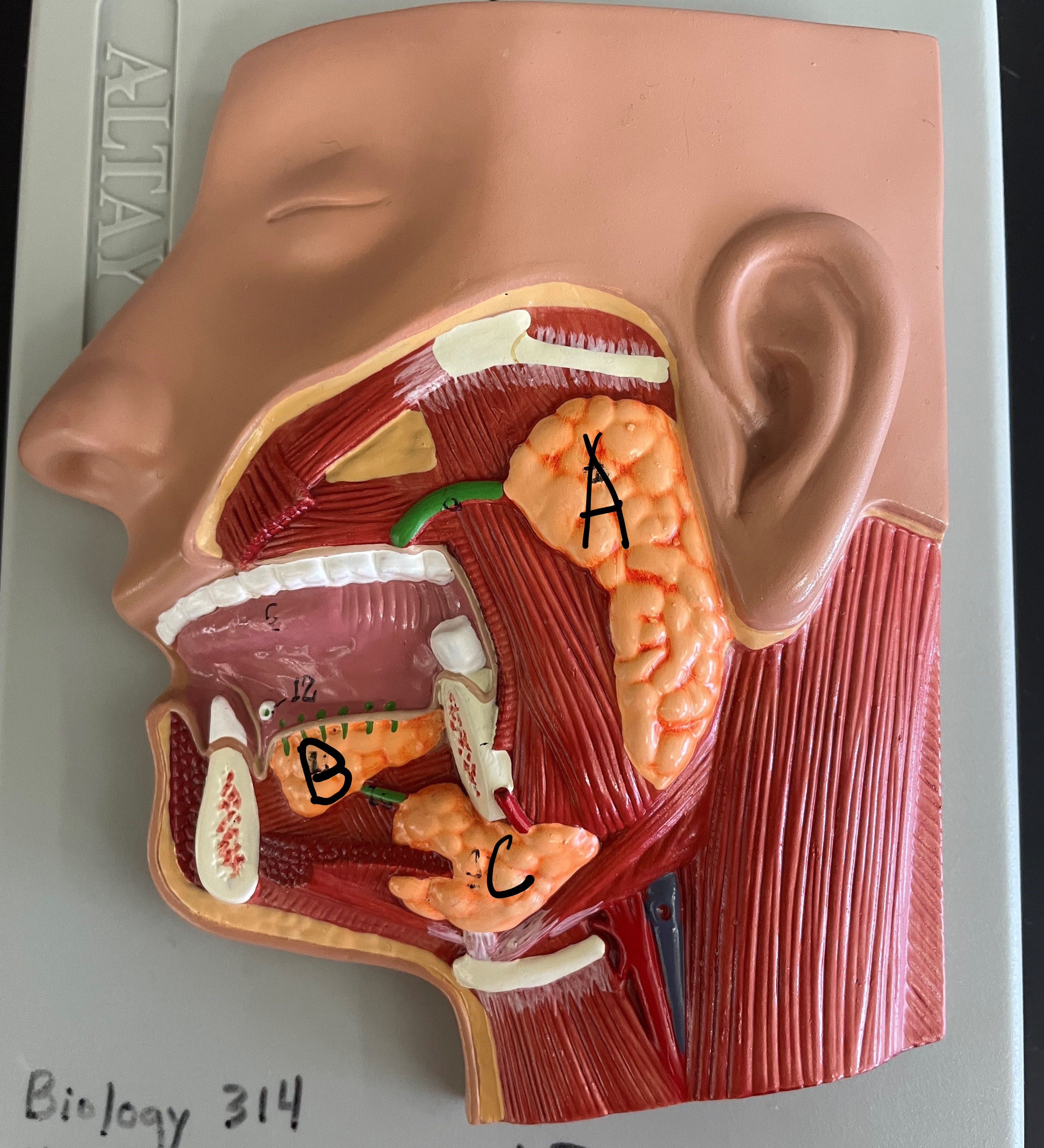 <p>B</p>
