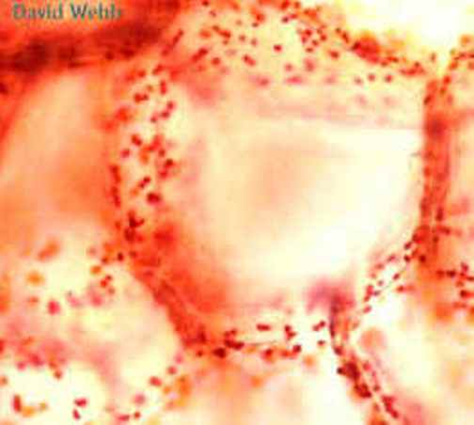 <p>Identify the vacuole, chromoplasts, and cytoplasm. What is inside the chromoplasts?</p>