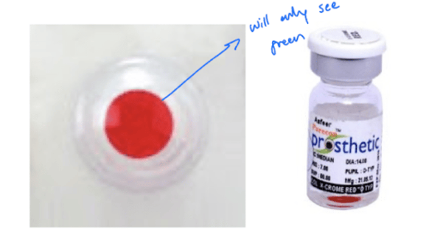<p>fitted colored contact lens on one eye</p>