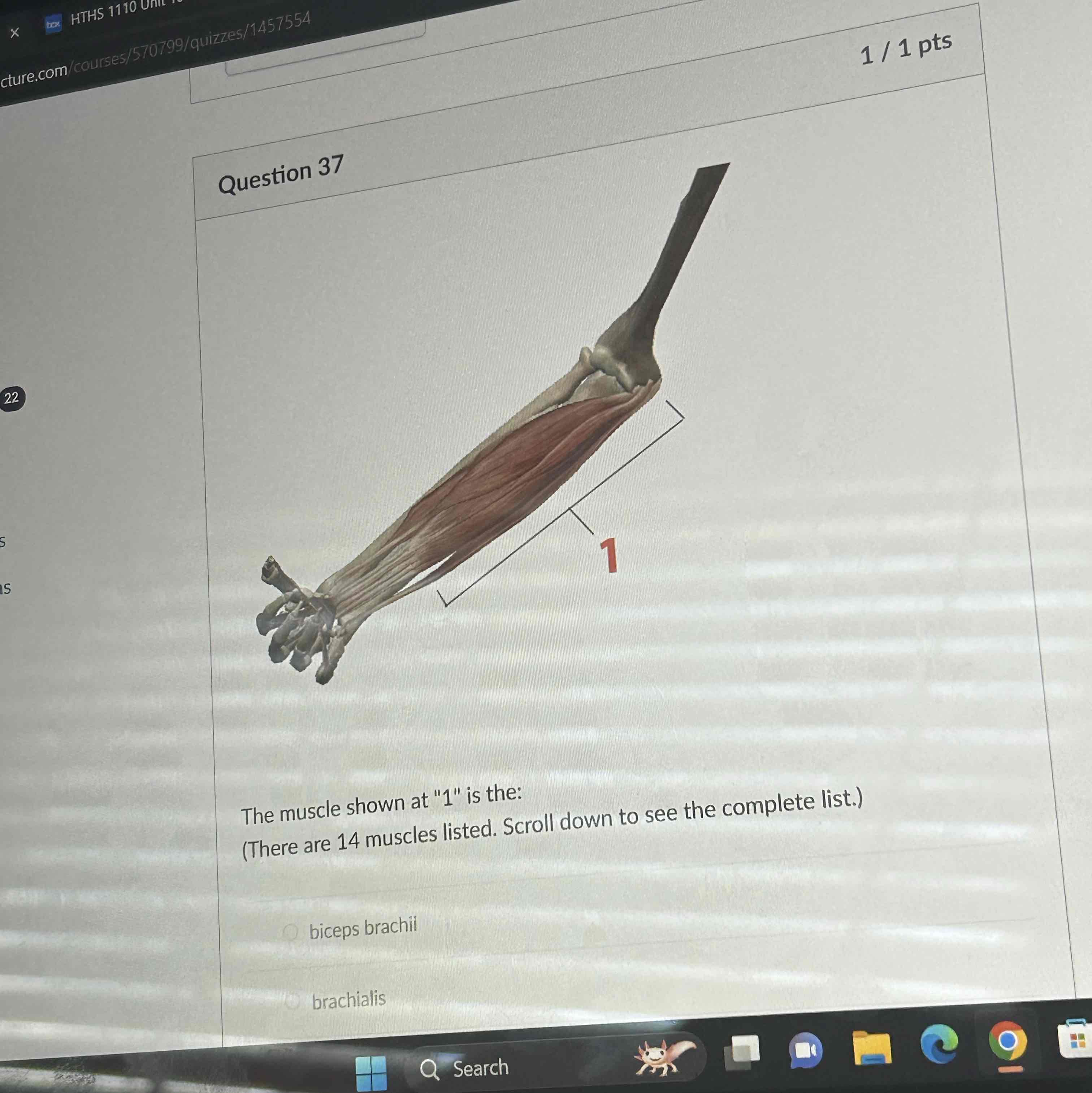 <p>The muscle shown at 1 is the </p>