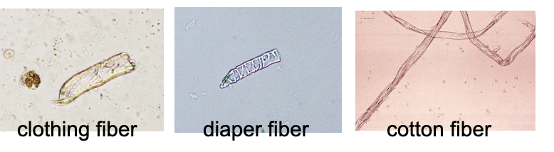 <ul><li><p class="">May mimic <strong>casts</strong> or <strong>parasites</strong></p></li><li><p class="">Types: clothing, diaper, cotton fibers</p></li><li><p class="">Key distinguishing traits:<br>• <strong>Highly refractile</strong><br>• <strong>Lack cast outline</strong></p></li><li><p class="">Careful observation under light microscopy essential</p><p class=""></p></li></ul><p></p>