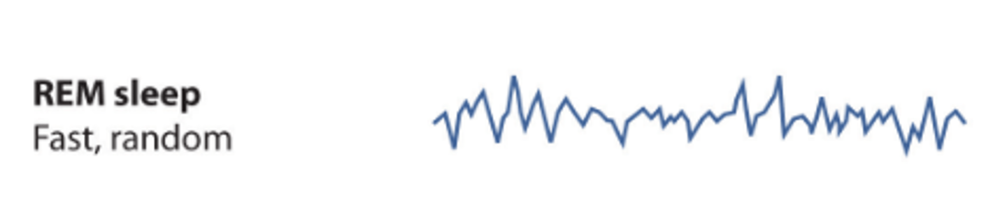 <p>Describe Stage REM Sleep</p>