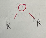 <p>Class: Ether<br>Example: Diethyl ether (C2H5OC2H5)</p>