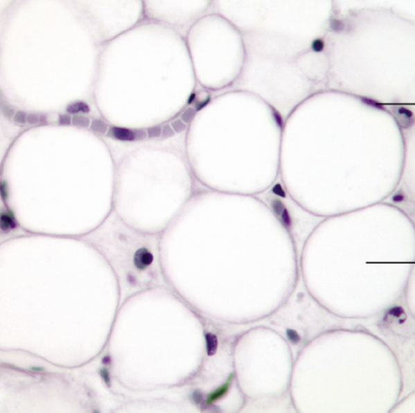<p>function- reserve food fuel, insulates, supports/protects organs </p><p>location- in subcutaneous tissue, around kidneys/eyes, in ab and breasts&nbsp;</p>