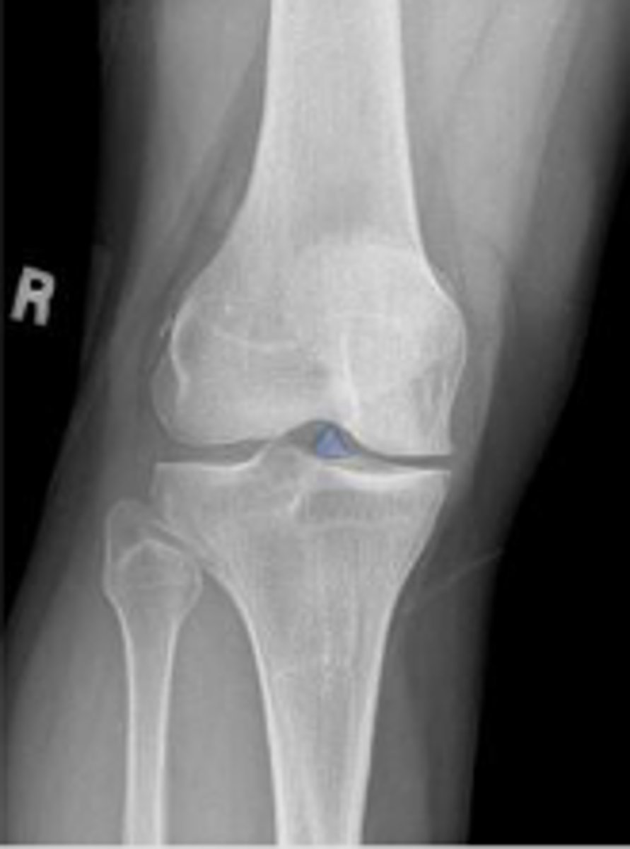 <p>What is outlined?</p>