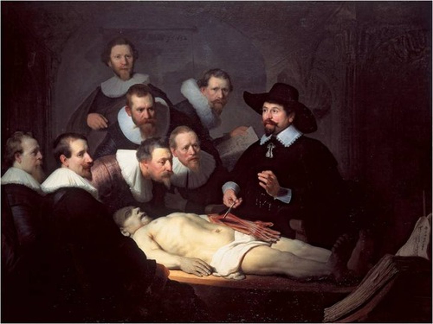 <p>amputations, surgeries without anesthesia</p>