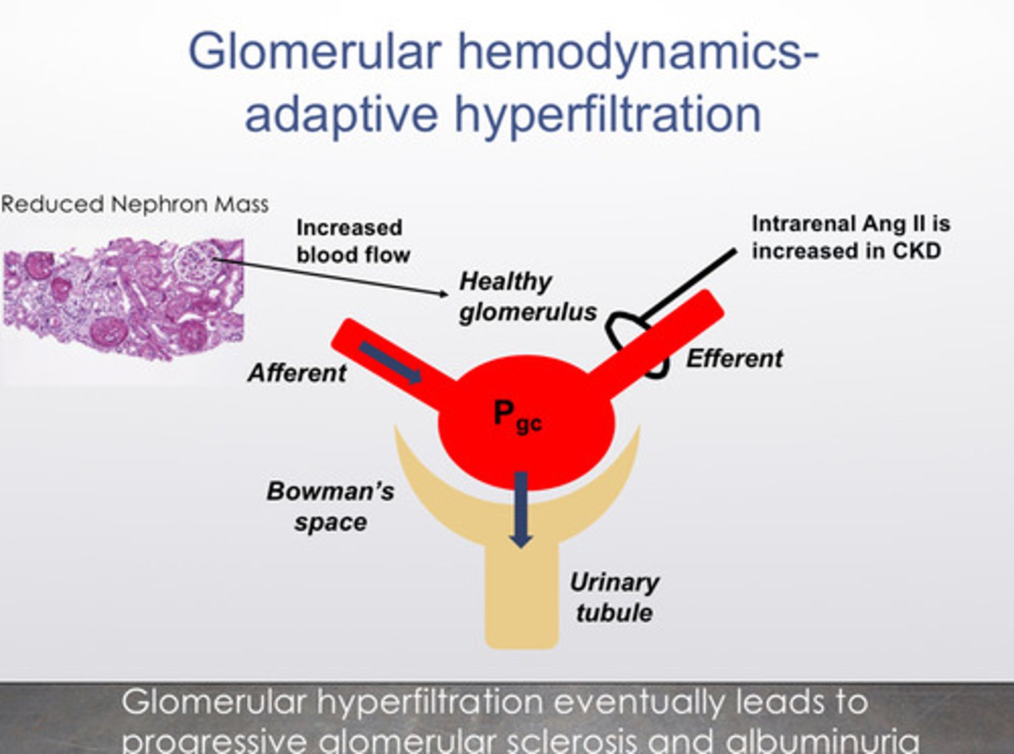 <p>1) this process continues even once the insults are well-controlled</p><p>2) fewer nephrons means that the remaining healthy nephrons see more blood flow, which increases glomerular capillary pressure</p><p>3) in CKD, intra-renal ang-II production increases —&gt; hyperfiltration preserves GFR but lead to increased glomerular pressure and glomerulosclerosis</p><p>the bottom line: glomerular hyperfiltration eventually leads to progressive glomerular sclerosis and albuminuria</p>