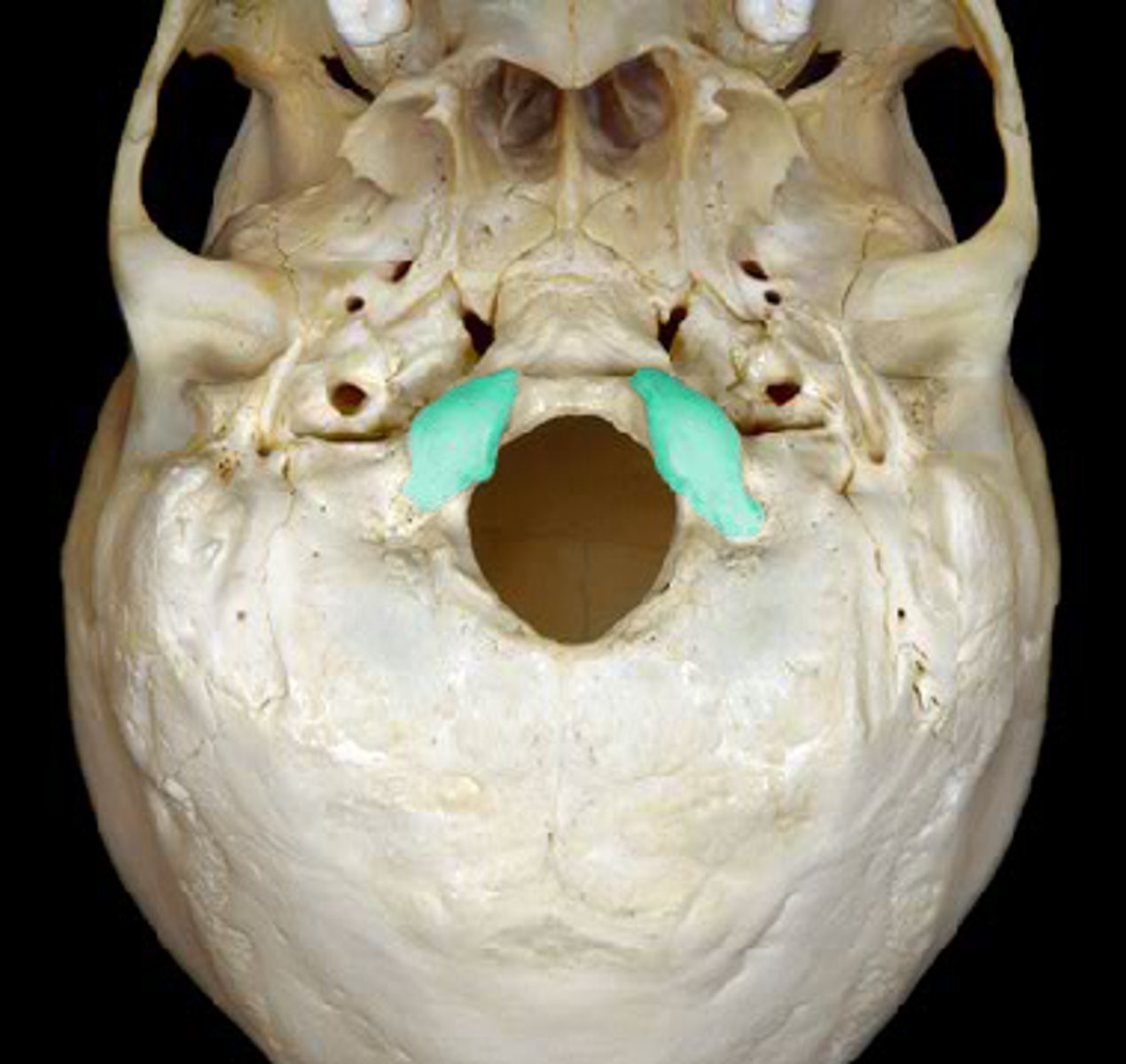 knowt flashcard image