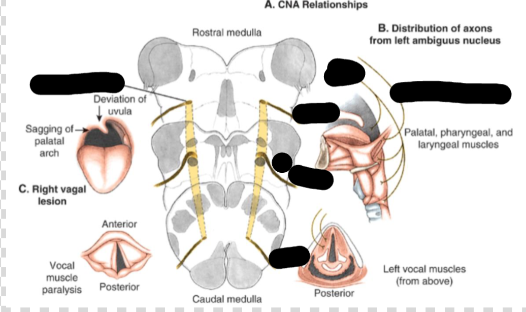 <p>what CN is the picture showing?</p>