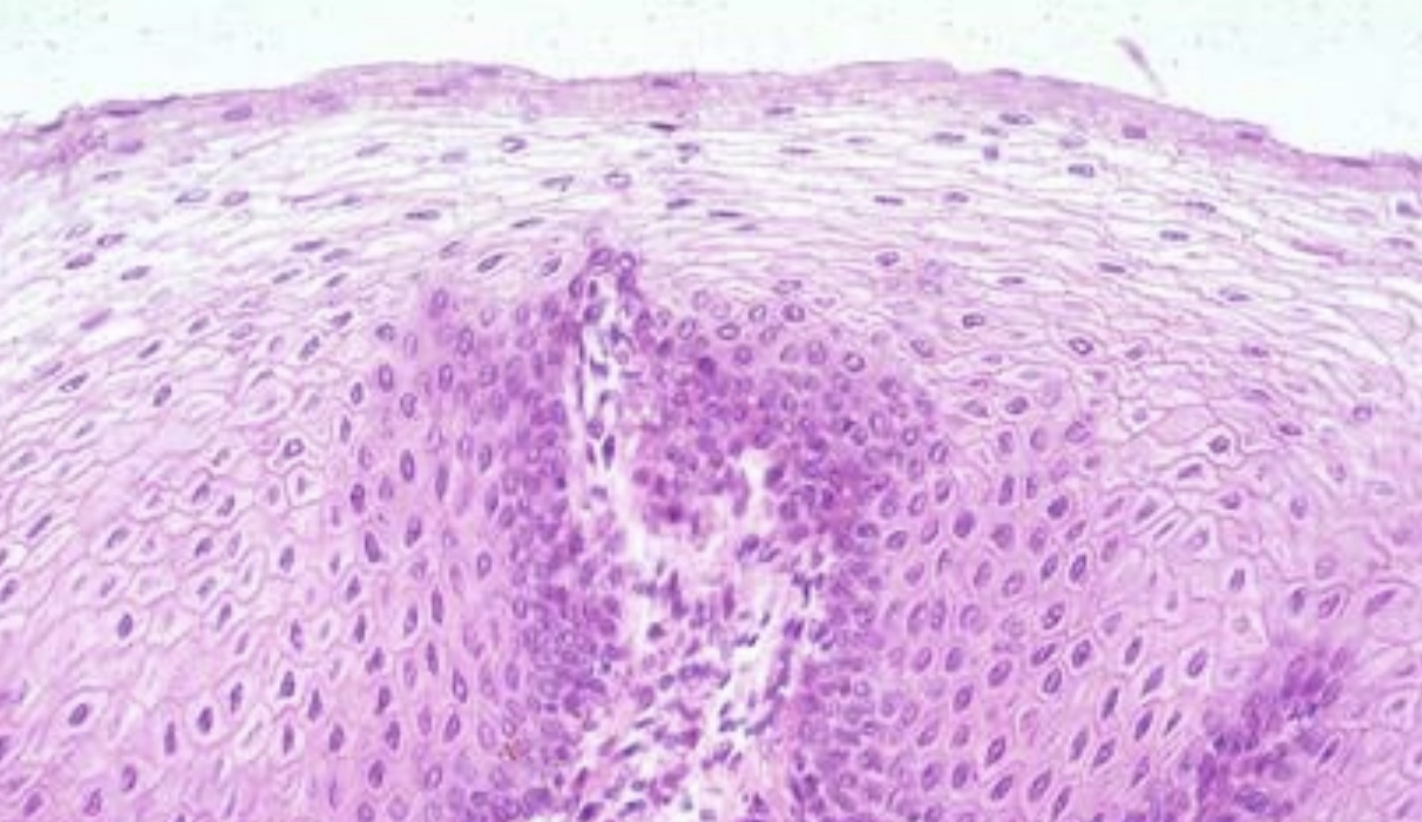What cell type is this?