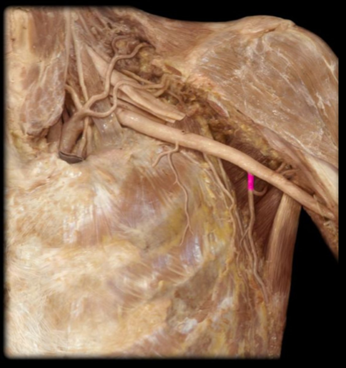 <p>What structure is shown?</p>