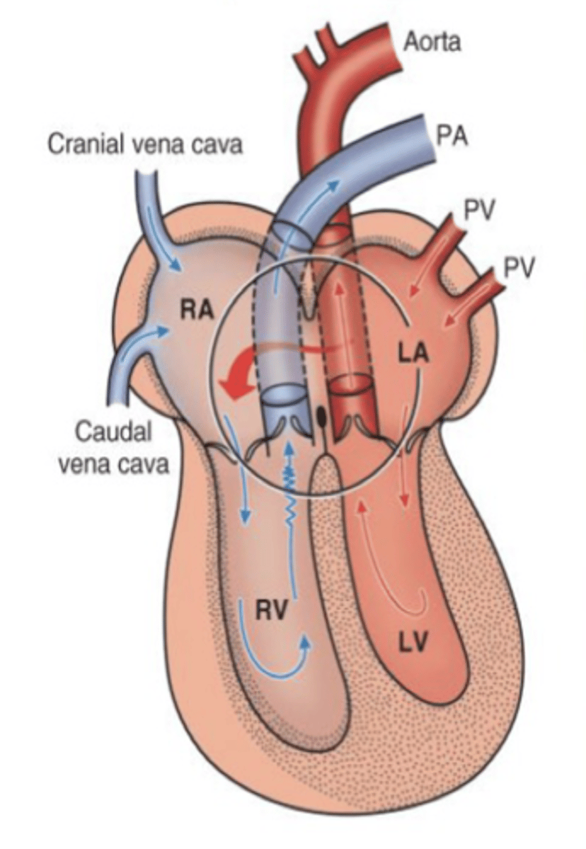 <p>Describe the hemodynamics of ASD</p>