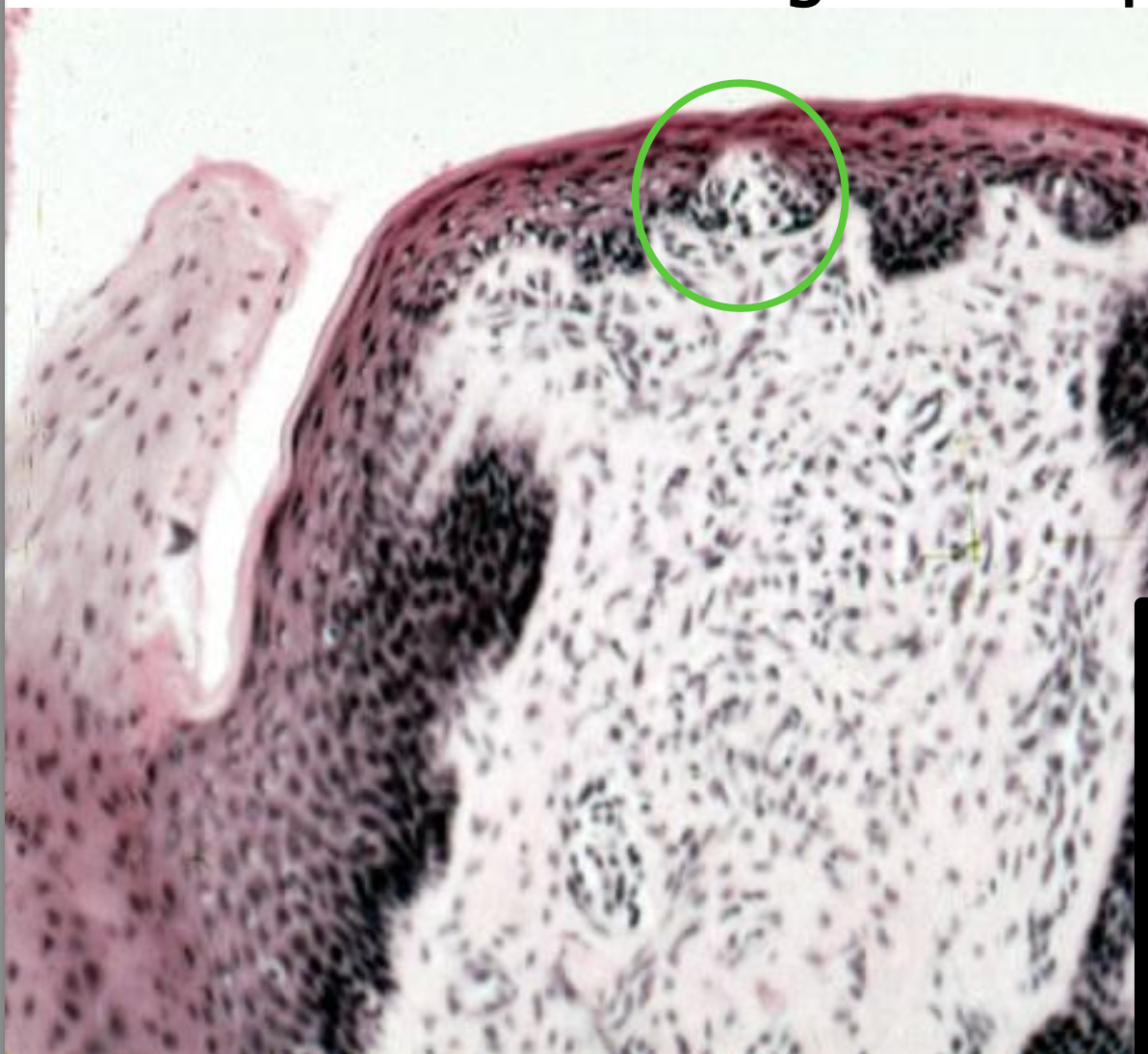 <p>ID the image. BE SPECIFIC</p>