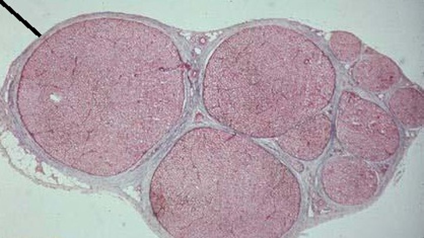 <p>surrounds the entire nerve</p>