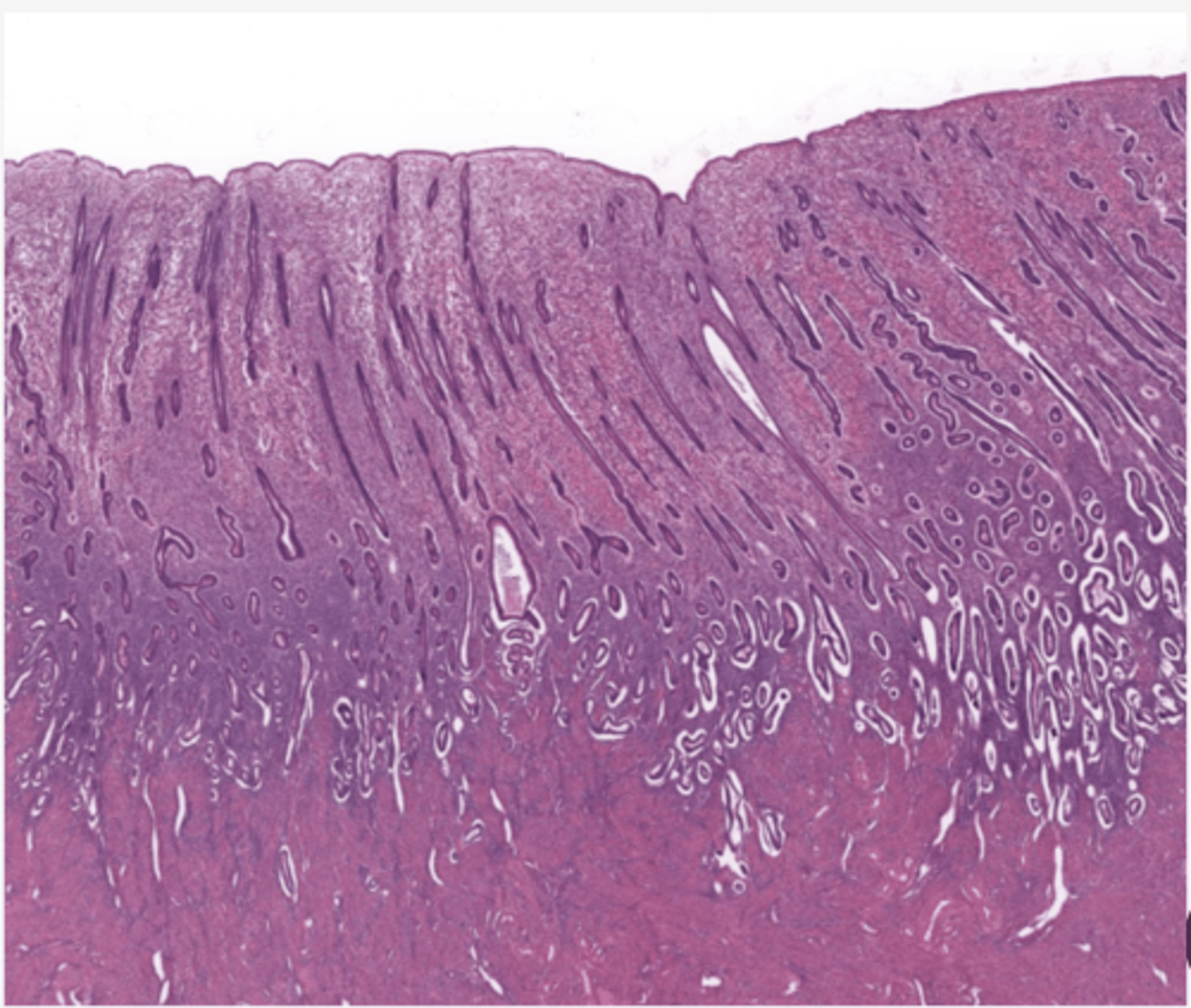 <p>Identify the stage of the uterus</p>