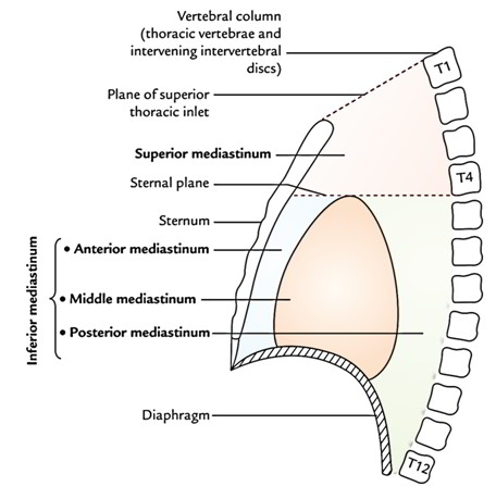 <p>The upper boundary of mediastinum superius is the plane between the sternal notch and Th1.</p><p><strong><mark data-color="red" style="background-color: red; color: inherit">A. Yes</mark></strong></p><ul><li><p>“thoracic inlet”</p></li><li><p>Inferior - Transverse thoracic plane</p><ul><li><p>from the <strong>manubriosternal joint</strong> to the <strong>intervertebral disc between T4 and T5</strong></p></li></ul></li><li><p>Anterior - <strong>Manubrium</strong> of the sternum</p></li><li><p>Posterior - <strong>Upper thoracic vertebrae</strong> → T1 to T4</p></li><li><p>Lateral - Mediastinal pleura (covering the lungs)</p></li></ul><p>B. No</p>