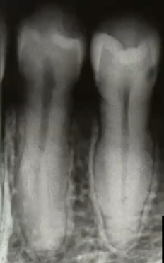 <p>diagnosis?</p>