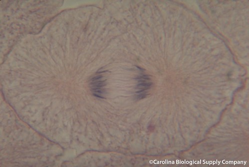 chromatids separate into chromosomes, 2 sets of chromosomes pulled by spindle fibers to opposite poles, cytokinesis begins towards end of this phase (plasma membrane pinches together along equator and create cleavage furrow)