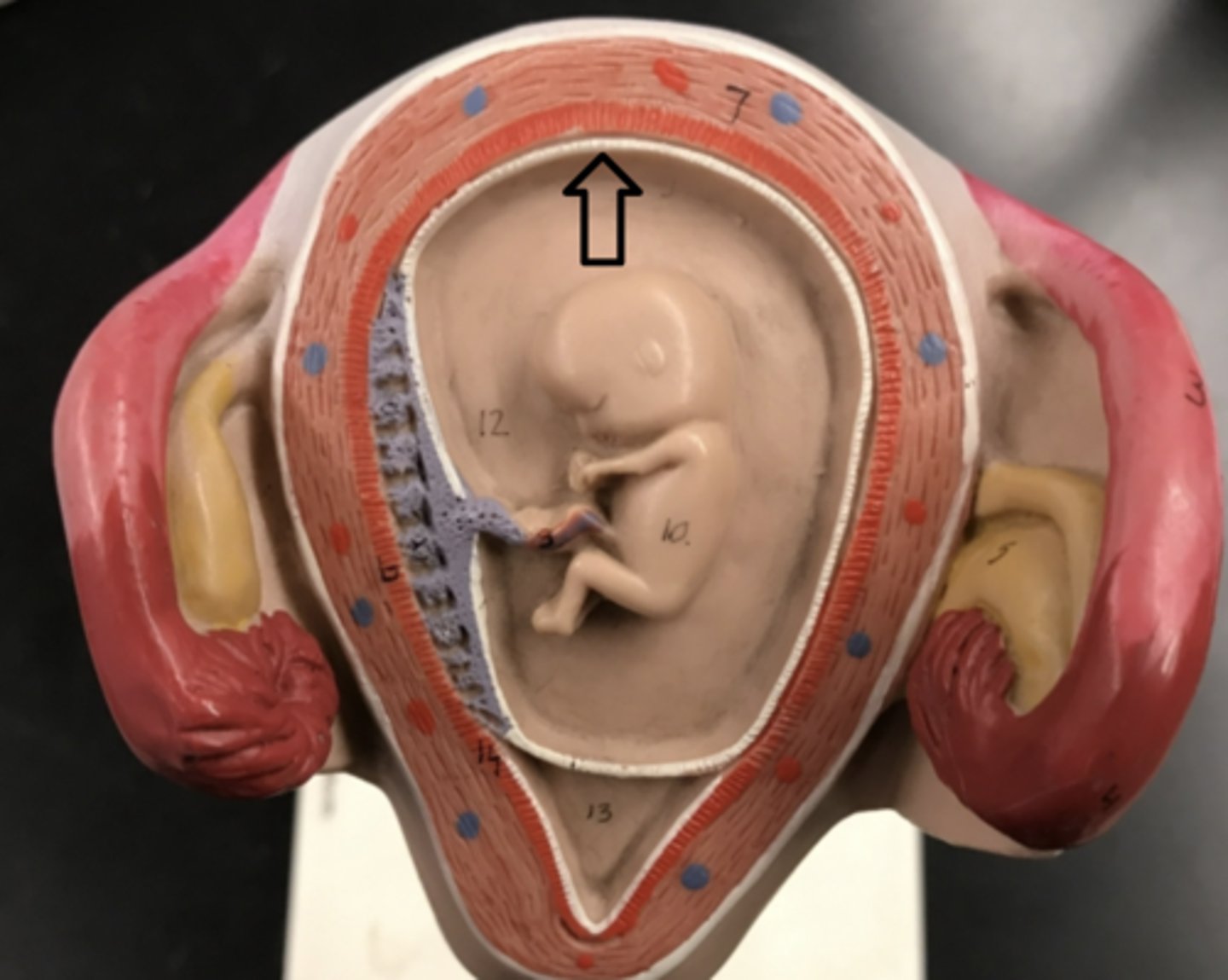 <p>name this LAYER</p><p>(white)</p>