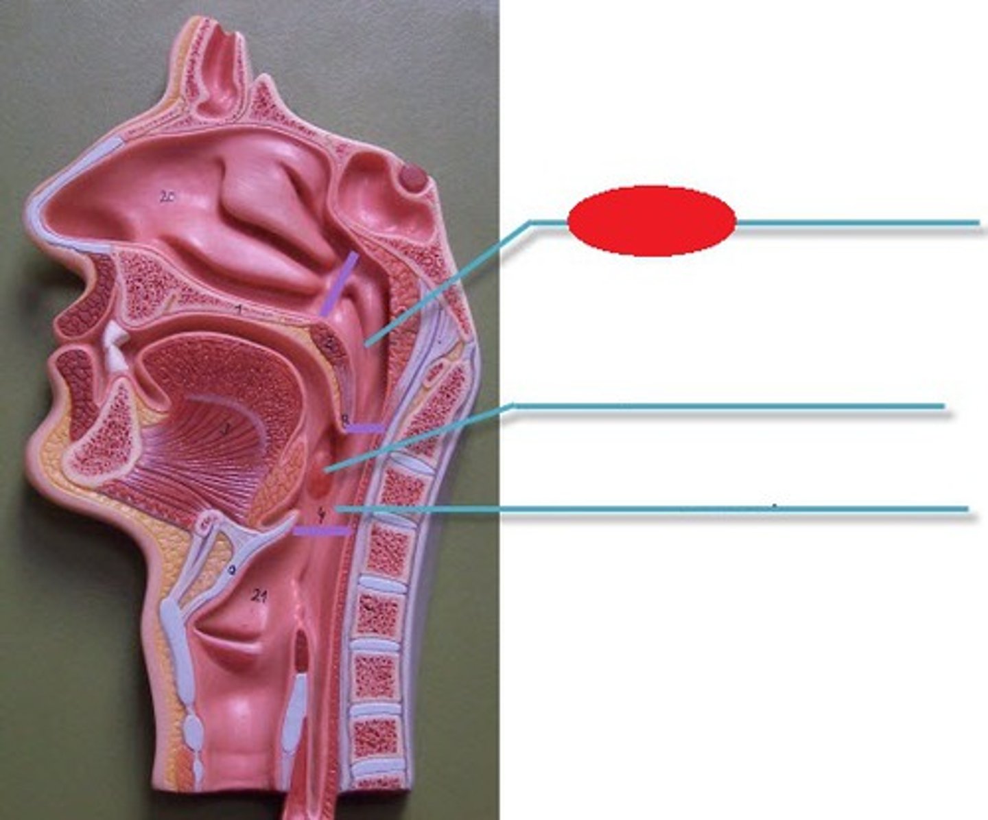 <p>Boundary</p><p>- On top portion of head</p>
