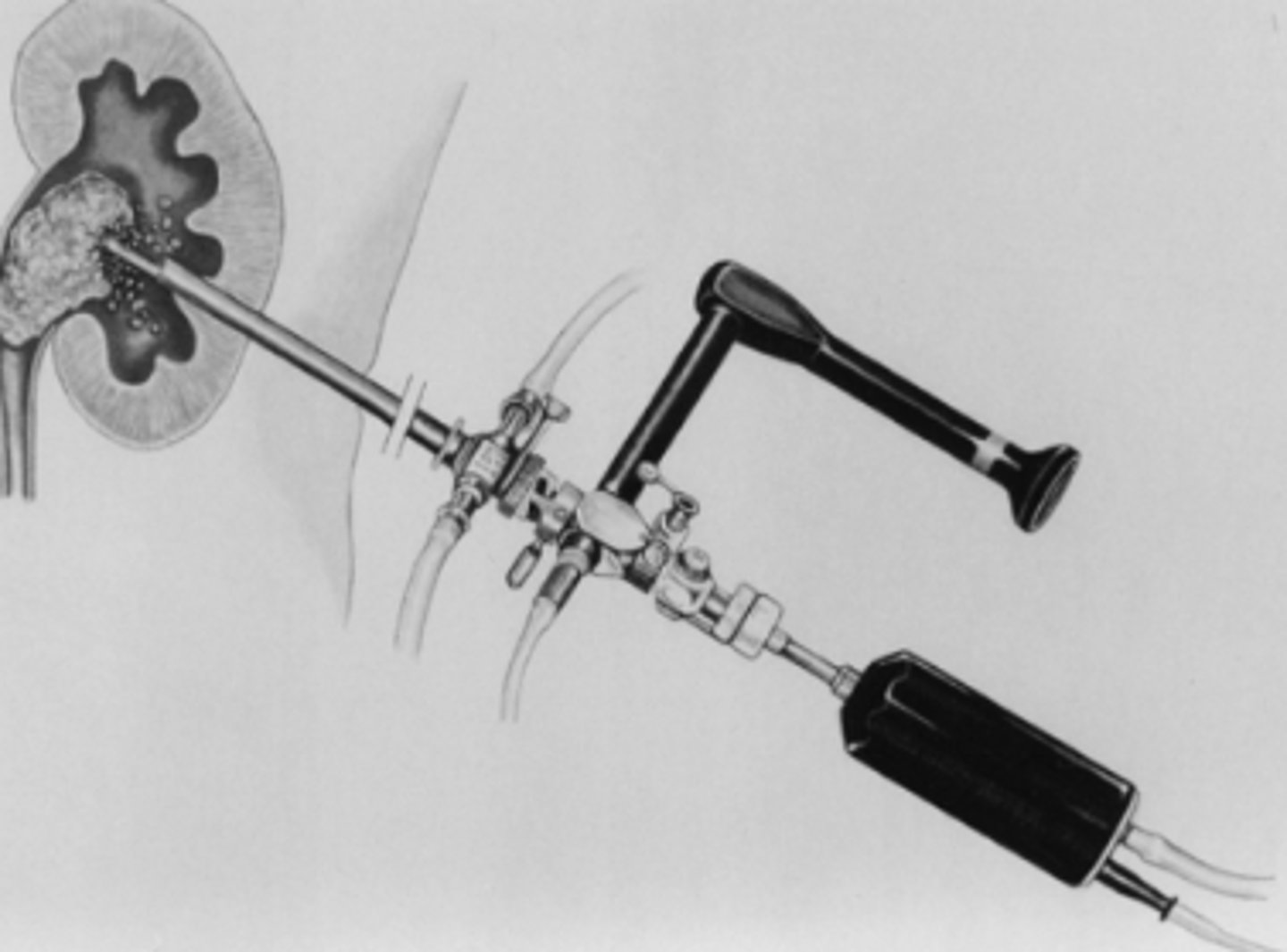 <p>Welke techniek is hier afgebeeld?</p>