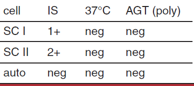 <p>possible interpretation of antibody screen </p>