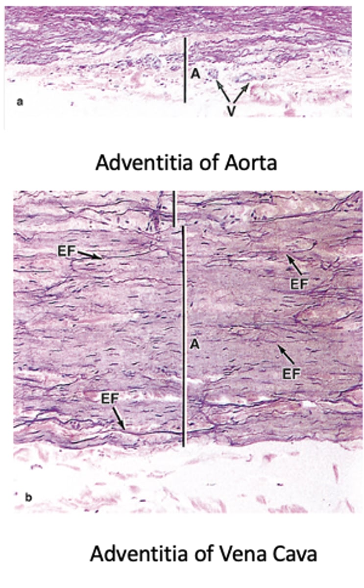 <p>How is the adventitia related to surrounding tissues?</p>