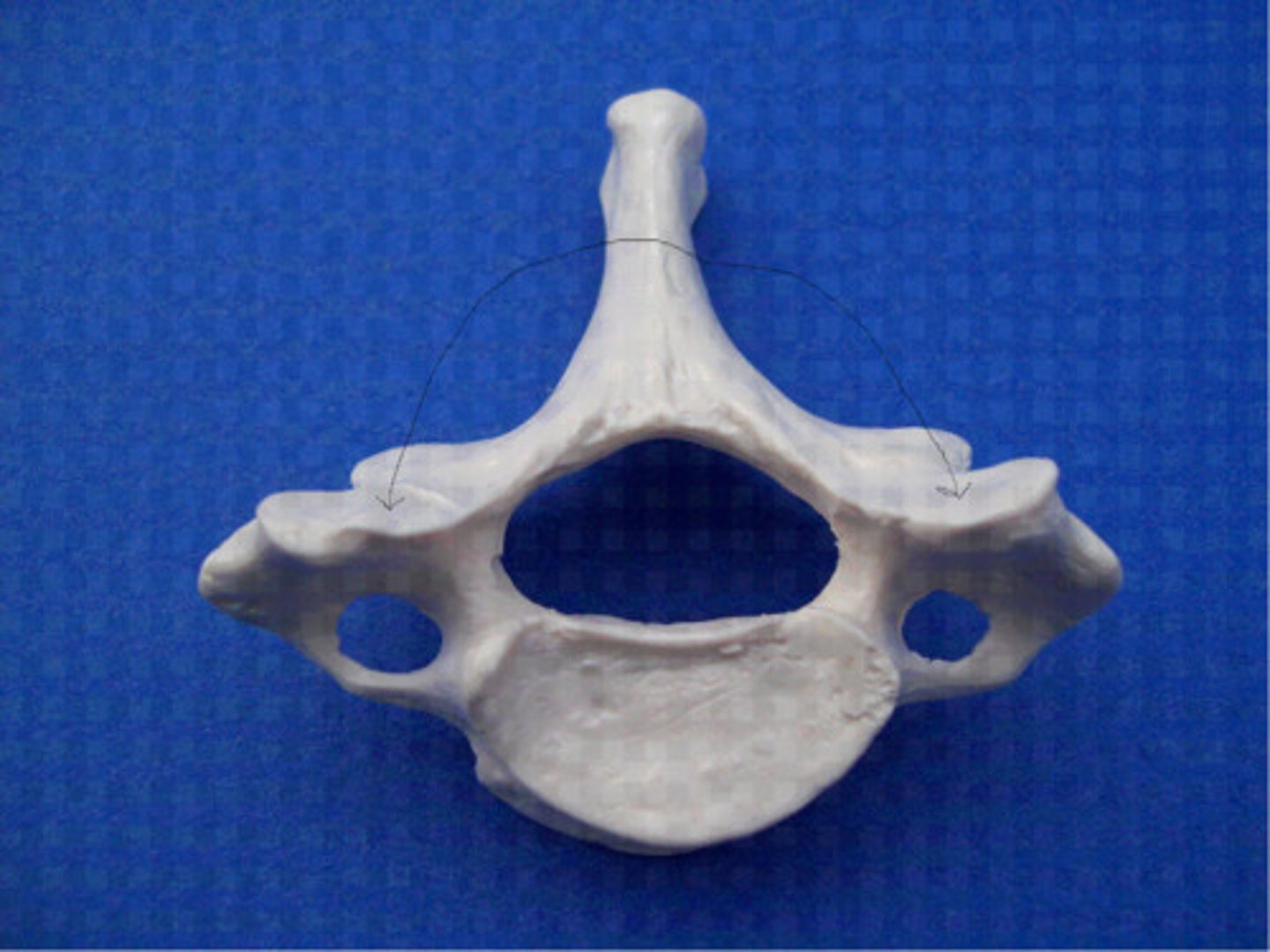 <p>Type?</p>