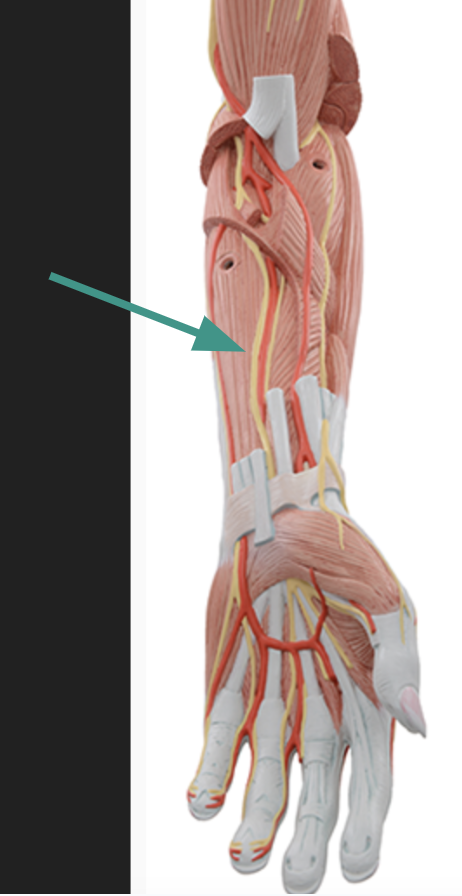 <p>flexor digitorum profundus m.</p><p>O: <span>proximal ulna and interosseous membrane</span><br>I: Base of distal phalanges of fingers 2-5<br>A: wrist flexion, MCP + IP + DIP flexion<br>Inn: medial n. and ulnar n. </p>