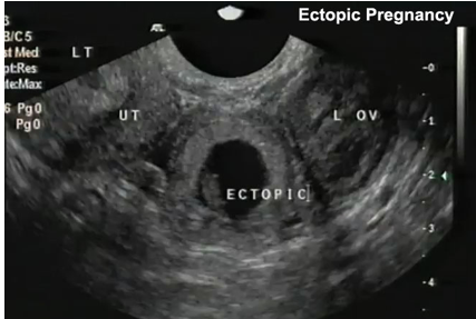 <p>what is shown?</p>