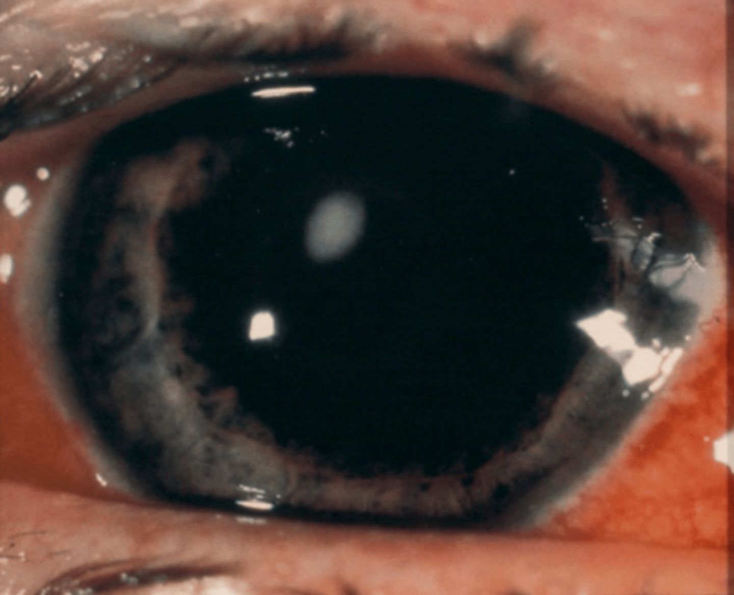 <p>Should we culture this lesion shown here?</p>