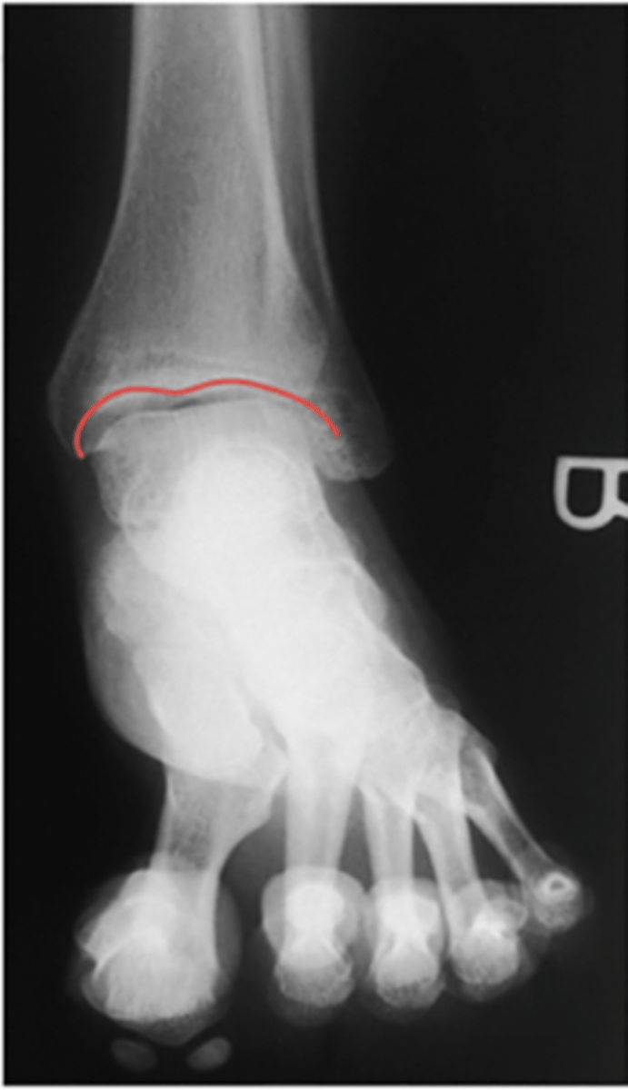 <p>What structure is highlighted?</p>