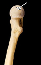 <p>femur, medial view, right side</p>